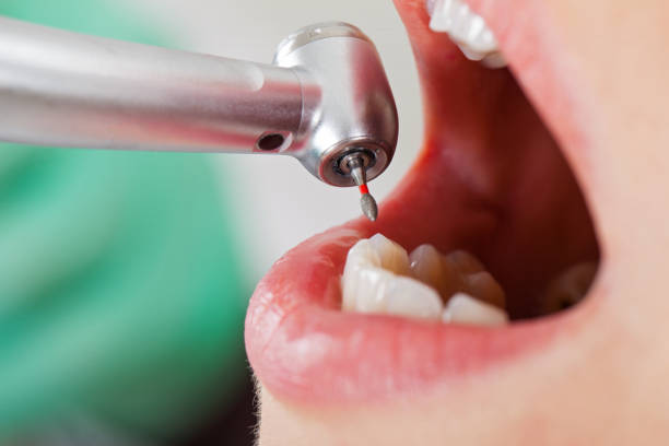 Best Emergency Denture Repair in Shannondale, WV